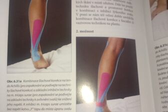 Kinesiotaping I, II a Lymfotaping - 2
