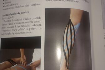 Kinesiotaping I, II a Lymfotaping - 3