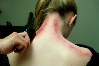 Gua Sha - regenerační čínská masáž - 2