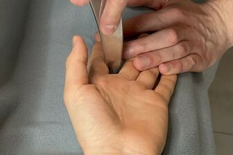 IASTM - mobilizace měkkých tkání pomocí instrumentů - 4