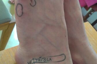 Reflexologie plosky nohy II – vnitřní orgány a diagnostika - 2